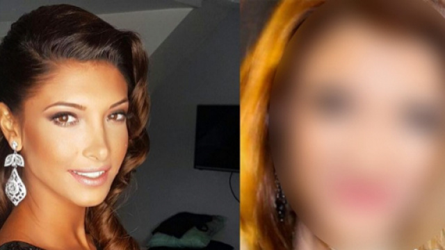 Mélanie Dédigama : Une nouvelle photo choc qui confirme les rumeurs de chirurgie esthétique !