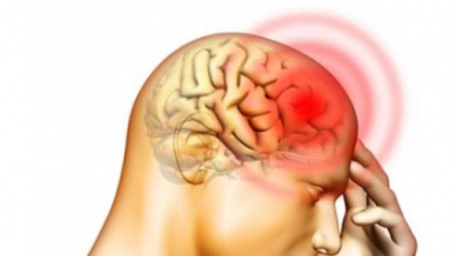 Sintomi della meningite (disegno)