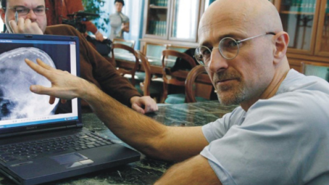 Trapianto di testa? La scienza non &egrave; convinta.