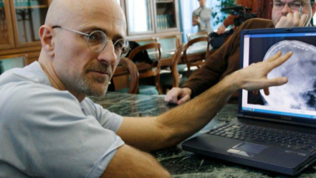 Sergio Canavero, autore del primo trapianto di cervello