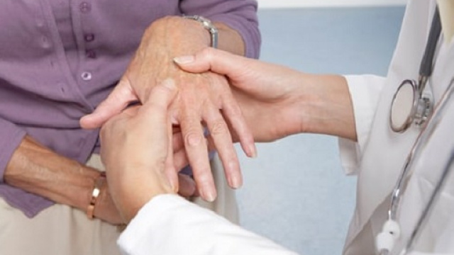 Artrite reumatoide, ecco come prevenirla