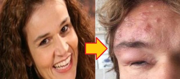 Claudia Rodrigues aparece com rosto deformado Claudia Rodrigues aparece com rosto deformado