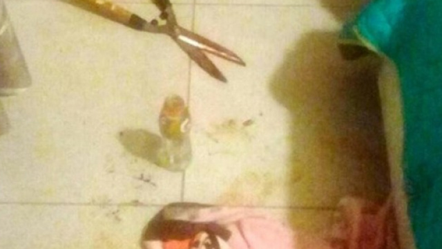 Taglia i genitali del marito con una cesoia