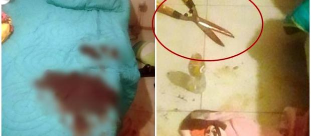 Homem tem órgão sexual decepado Homem tem órgão sexual decepado