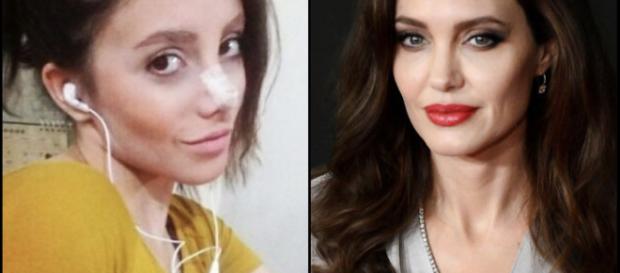 Sahar quando se submeteu à primeira cirurgia no nariz Sahar quando se submeteu à primeira cirurgia no nariz