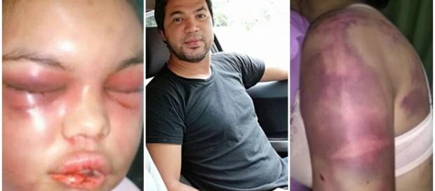 Jovem é vítima de violência doméstica Jovem é vítima de violência doméstica