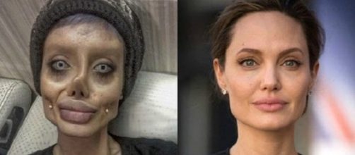 La ragazza che si è sottoposta a 50 operazioni chirurgiche per somigliare alla Jolie.