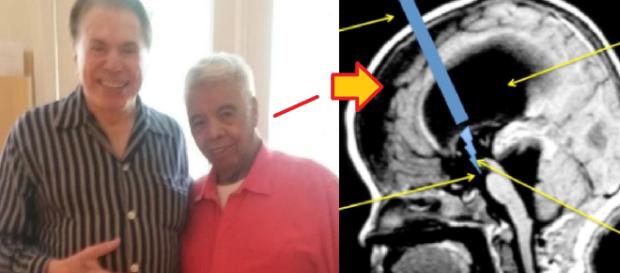 Roque, do Silvio Santos, passará por cirurgia Roque, do Silvio Santos, passará por cirurgia