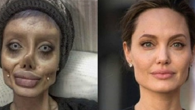 La ragazza che si è sottoposta a 50 operazioni chirurgiche per somigliare alla Jolie.