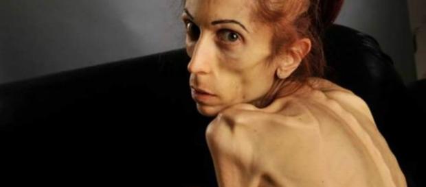 Atriz foi rejeitada em vários hospitais, por acharem seu caso muito grave Atriz foi rejeitada em vários hospitais, por acharem seu caso muito grave