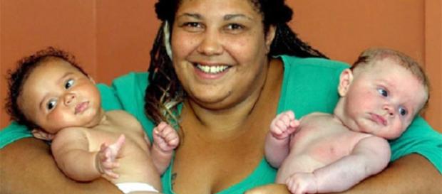 Mulher teve gêmeos de pais diferentes Mulher teve gêmeos de pais diferentes