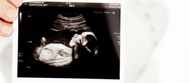 State laws differ about the legal status of unborn children. Photo by PublicDomainPictures at Pixabay.com, Creative Commons license. State laws differ about the legal status of unborn children. Photo by PublicDomainPictures at Pixabay.com, Creative Commons license.