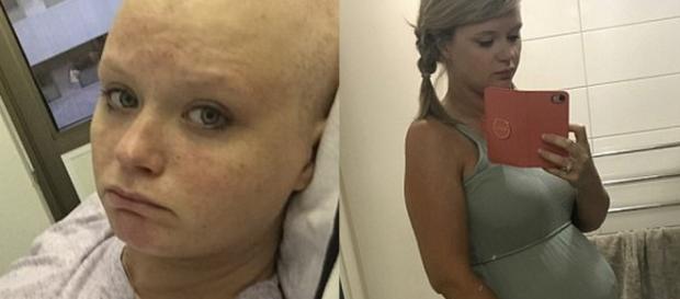 Após ter desenvolvido gravidez molar, Lauren Knowles conseguiu dar à luz sua segunda criança (Crédito: Caters News Agency) Após ter desenvolvido gravidez molar, Lauren Knowles conseguiu dar à luz sua segunda criança (Crédito: Caters News Agency)