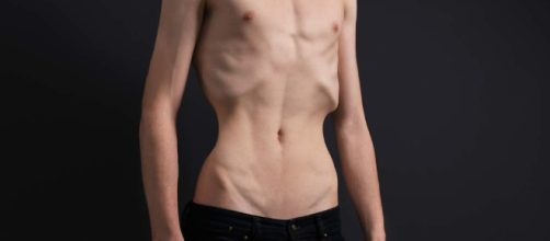 Disturbi alimentari, sempre più maschi affetti da anoressia | Vvox - vvox.it