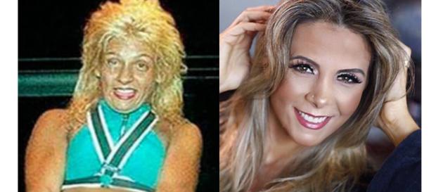 O antes e depois dessas celebridades impressiona O antes e depois dessas celebridades impressiona