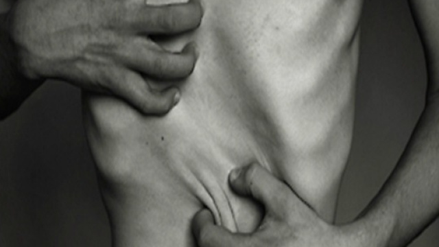 20enne sconfigge l'anoressia: ecco cosa le ha salvato la vita dal disagio