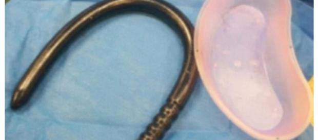 Homem vai parar no hospital para remoção de objeto Homem vai parar no hospital para remoção de objeto