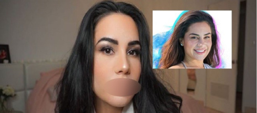 Milla Jasmine : sa dernière opération de chirurgie esthétique choque ses fans !