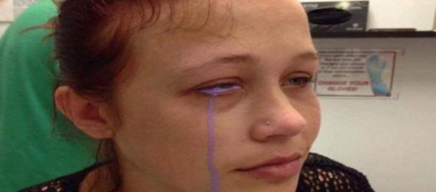 Chorando lágrimas roxas por causa de uma tatuagem Chorando lágrimas roxas por causa de uma tatuagem
