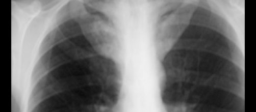 La radiografía no se debe solicitar a todos los pacientes. Public Domain.