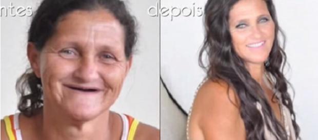Sissi estava há mais de 20 anos sem dentes Sissi estava há mais de 20 anos sem dentes
