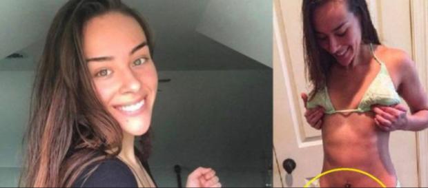 Conheça a história da jovem que decidiu romper com os padrões da beleza. Conheça a história da jovem que decidiu romper com os padrões da beleza.