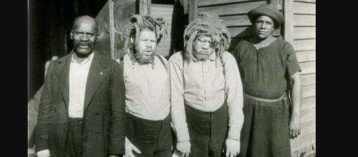 Eko and Iko the albino twins returned from the circus.(Image via Beth Macy Truvine search for truth/The Roanoke Times).