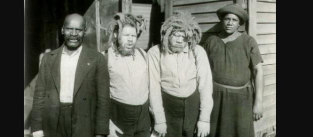 Eko and Iko the albino twins returned from the circus.(Image via Beth Macy Truvine search for truth/The Roanoke Times). Eko and Iko the albino twins returned from the circus.(Image via Beth Macy Truvine search for truth/The Roanoke Times).