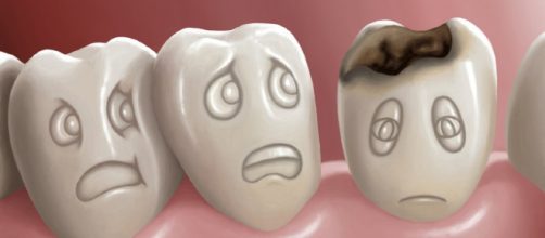 Qué causa, las caries dentales? - Mundo Odontólogo - mundoodontologo.com