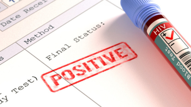 What are HIV and AIDS, what are the symptoms, how is the virus ... - thesun.co.uk