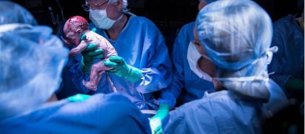 Mulher com útero transplantado dá à luz pela primeira vez nos EUA. Mulher com útero transplantado dá à luz pela primeira vez nos EUA.