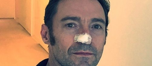 It's deja vu for Hugh Jackman as he gets another cancer treatment for his nose. / Photo from 'The Mirror' - mirror.co.uk