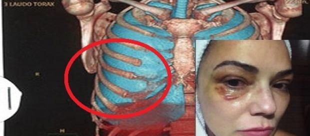 Imagem do exame de corpo de delito de Luiza Brunet Imagem do exame de corpo de delito de Luiza Brunet