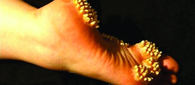 Seis fatos nojentos sobre o corpo humano Seis fatos nojentos sobre o corpo humano