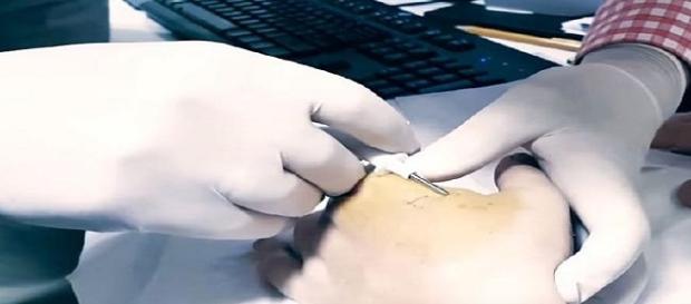 Aplicação do microchip sendo feita na mão de usuário Aplicação do microchip sendo feita na mão de usuário