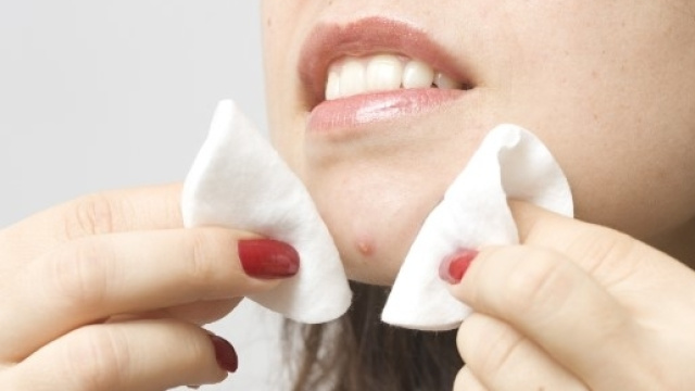 Quella mania di schiacciare i punti neri - onet. Kobieta