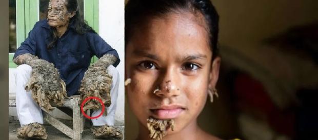 Veja a menina que sofre com doença rara Veja a menina que sofre com doença rara
