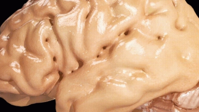 Could brain infection set the stage for Alzheimer's? | Public ... - pri.org