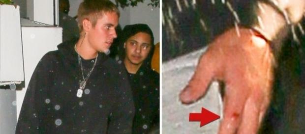 Justin Bieber saiu ferido da festa após agredir fã (Foto: Reprodução) Justin Bieber saiu ferido da festa após agredir fã (Foto: Reprodução)
