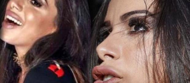 Anitta ficou com a boca muito inchada pelo botox. Anitta ficou com a boca muito inchada pelo botox.