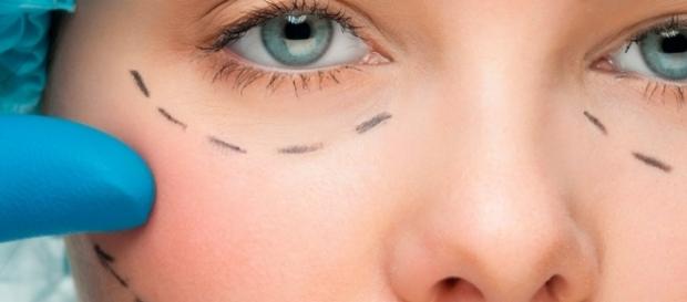Cirurgia estética funcional é a nova moda para afinar o rosto Cirurgia estética funcional é a nova moda para afinar o rosto