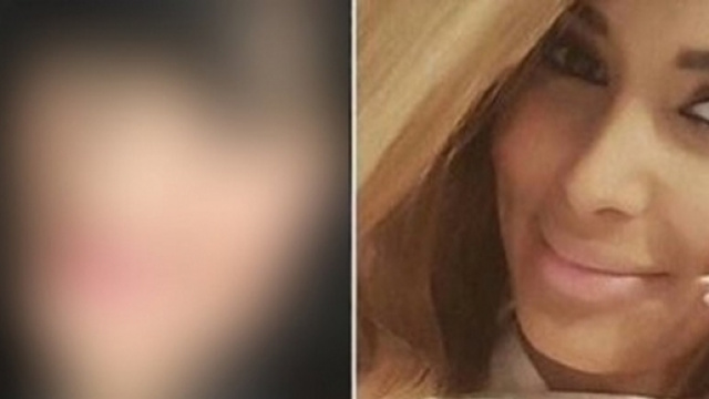 Nesma des Anges 9 avant/apr&egrave;s chirurgie esth&eacute;tique