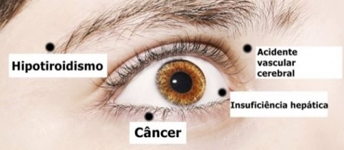 Seja um simples terçol ou uma visão turva, qualquer sinal que apareça nos olhos pode indicar um problema de saúde