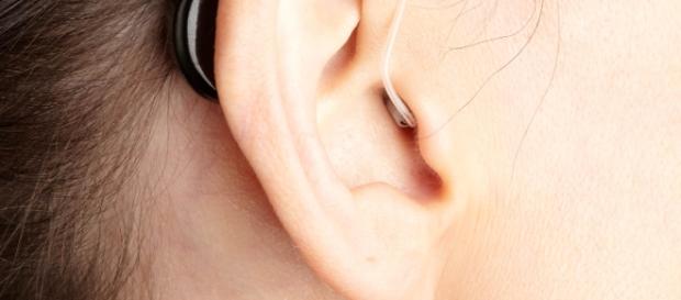 Stem cells used to tackle disabilities/Photo via https://upload.wikimedia.org/wikipedia/commons/7/7e/Wearing_SoundBite_Behind-the-Ear_Device.jpg Stem cells used to tackle disabilities/Photo via https://upload.wikimedia.org/wikipedia/commons/7/7e/Wearing_SoundBite_Behind-the-Ear_Device.jpg