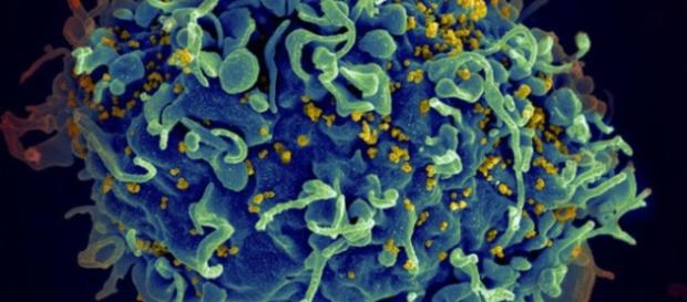 Un vaccin universel contre le VIH (sida) aurait été mis au point ... - science-et-vie.com Un vaccin universel contre le VIH (sida) aurait été mis au point ... - science-et-vie.com