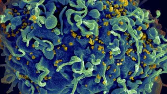 Un vaccin universel contre le VIH (sida) aurait été mis au point ... - science-et-vie.com