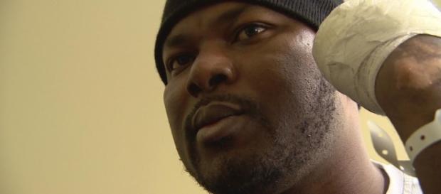 Asylum seekers learning to cope without hands after frostbitten Asylum seekers learning to cope without hands after frostbitten