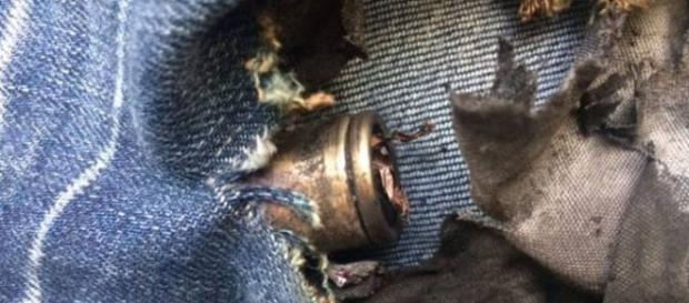 E-cigarette battery explosion image credit Global news E-cigarette battery explosion image credit Global news
