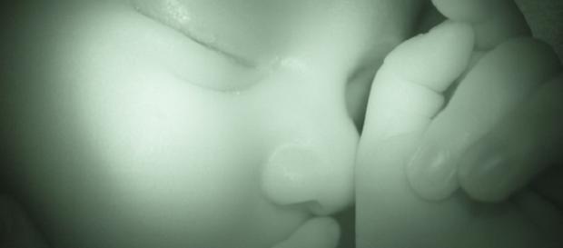 Niños adoptados en Europa del Este que sufren de SAF Niños adoptados en Europa del Este que sufren de SAF