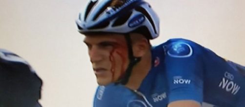 Marcel Kittel dopo il colpo subito da Grivko